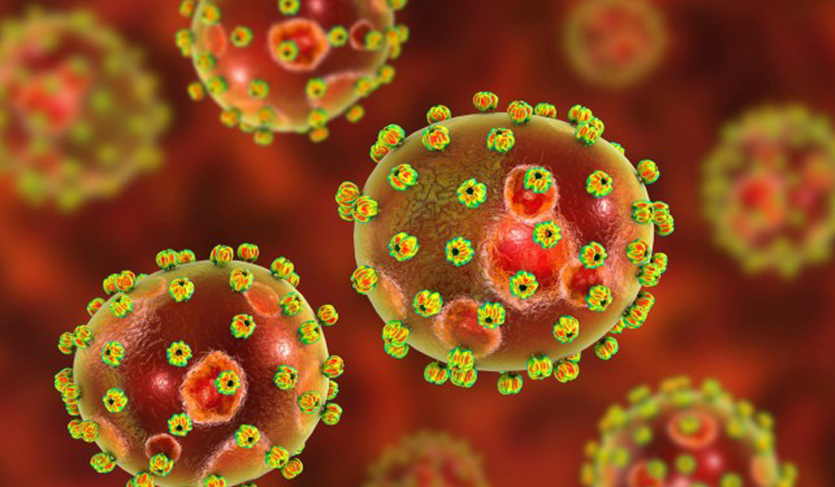 Lassa Fever